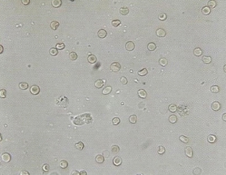 urine